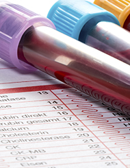 Hamilton Doctors Test Results